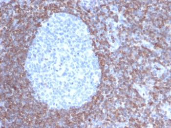 IHC staining of FFPE human tonsil tissue with Bcl-2 antibody (clone BCL2/6915). HIER: boil tissue sections in pH 9 10mM Tris with 1mM EDTA for 20 min and allow to cool before testing.