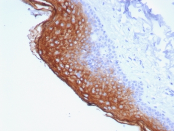 IHC staining of FFPE human skin tissue with Suprabasin antibody (clone SBSN/7964). HIER: boil tissue sections in pH 9 10mM Tris with 1mM EDTA for 20 min and allow to cool before testing.