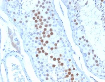 IHC staining of FFPE human testis tissue with KIF2C antibody (clone KIF2C/6528) at 2ug/ml. HIER: boil tissue sections in pH 9 10mM Tris with 1mM EDTA for 20 min and allow to cool before testing.