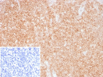 IHC staining of FFPE human tonsil tissue with recombinant CD48 antibody (clone CD48/8360R). Inset: PBS used in place of primary Ab (secondary Ab negative control). HIER: boil tissue sections in pH 9 10mM Tris with 1mM EDTA for 20 min and allow to cool before testing.