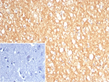 IHC staining of FFPE human brain tissue with S100A5 antibody (clone S100A5/7474). Inset: PBS used in place of primary Ab (secondary Ab negative control). HIER: boil tissue sections in pH 9 10mM Tris with 1mM EDTA for 20 min and allow to cool before testing.