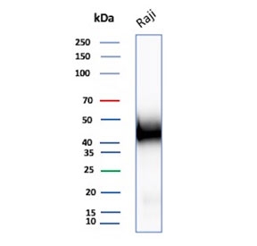 IHC staining of FFPE human tonsil tissue with CD48 antibody (clone rCD48/8834). Inset: PBS used in place of primary Ab (secondary Ab negative control). HIER: boil tissue sections in pH 9 10mM Tris with 1mM EDTA for 20 min and allow to cool before testing.