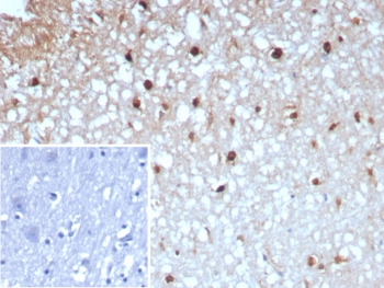 IHC staining of FFPE human brain tissue with GLUL antibody (clone GLUL/8996R). Inset: PBS used in place of primary Ab (secondary Ab negative control). HIER: boil tissue sections in pH 9 10mM Tris with 1mM EDTA for 20 min and allow to cool before testing.