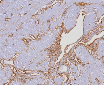 IHC staining of FFPE human uterus tissue with CD34 antibody (clone HPCA1/4393R). HIER: boil tissue sections in pH 9 10mM Tris with 1mM EDTA for 20 min and allow to cool before testing.