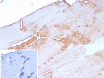 IHC staining of FFPE human skeletal muscle tissue with ACTN2 antibody (clone rACTN2/8177). Inset: PBS used in place of primary Ab (secondary Ab negative control). HIER: boil tissue sections in pH 9 10mM Tris with 1mM EDTA for 20 min and allow to cool before testing.