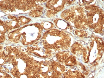 IHC staining of FFPE human prostate tissue with MIF antibody (clone MIF/6280). HIER: boil tissue sections in pH 9 10mM Tris with 1mM EDTA for 20 min and allow to cool before testing.