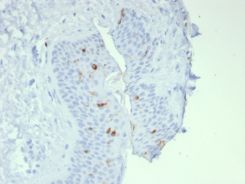 IHC staining of FFPE human skin tissue with Langerin antibody (clone LGRN/7541). HIER: boil tissue sections in pH 9 10mM Tris with 1mM EDTA for 20 min and allow to cool before testing.