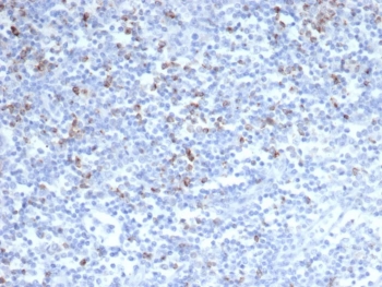 IHC staining of FFPE human tonsil tissue with CTLA4 antibody (clone CTLA4/6864R). HIER: boil tissue sections in pH 9 10mM Tris with 1mM EDTA for 20 min and allow to cool before testing.