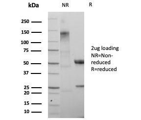SDS-PAGE analysis of purified, BSA-free SATB2 antibody (clone rSATB2/8635) as confirmation of integrity and purity.