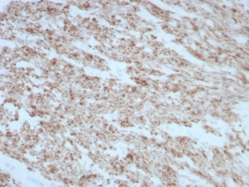 IHC staining of FFPE human smooth muscle tissue with DES antibody (clone rDES/8846). HIER: boil tissue sections in pH 9 10mM Tris with 1mM EDTA for 20 min and allow to cool before testing.