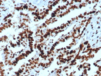 Western blot testing of human A431 cell lysate with MCM2 antibody. Commonly observed at 100-130 kDa.