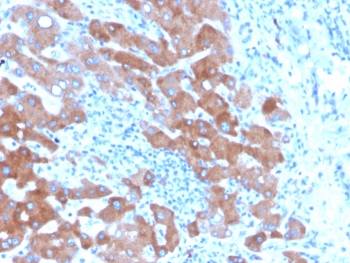 IHC staining of FFPE human liver tissue with Transferrin antibody (clone TF/4796). HIER: boil tissue sections in pH 9 10mM Tris with 1mM EDTA for 20 min and allow to cool before testing.