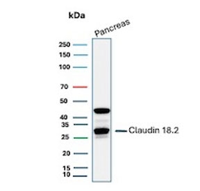 IHC staining of FFPE human pancreas tissue with Claudin18.2 antibody (clone CLDN18.2/8559R). Inset: PBS used in place of primary Ab (secondary Ab negative control). HIER: boil tissue sections in pH 9 10mM Tris with 1mM EDTA for 20 min and allow to cool before testing.