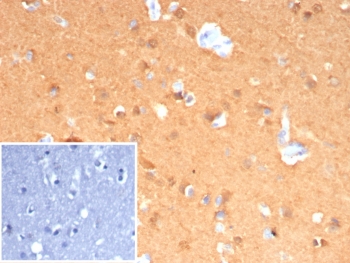 IHC staining of FFPE human cerebellum tissue with UchL1 antibody (clone rUCHL1/8133). Inset: PBS used in place of primary Ab (secondary Ab negative control). HIER: boil tissue sections in pH 9 10mM Tris with 1mM EDTA for 20 min and allow to cool before testing.