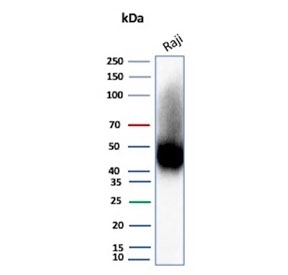 Western blot testing of human Raji cell lysate with CD38 antibody (clone rCD38/8045). Expected molecular weight: 34-46 kDa depending on glycosylation level.