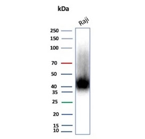 Western blot testing of human Raji cell lysate with CD38 antibody (clone rCD38/8334). Expected molecular weight: 34-46 kDa depending on glycosylation level.