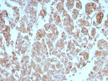 IHC staining of FFPE human adrenal gland tissue with Interleukin-2 antibody (clone IL2/8712). HIER: boil tissue sections in pH 9 10mM Tris with 1mM EDTA for 20 min and allow to cool before testing.