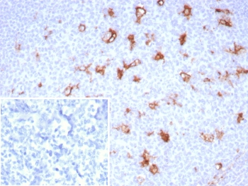 IHC staining of FFPE human tonsil tissue with SPARC antibody (clone OSTN/8528R). Inset: PBS used in place of primary Ab (secondary Ab negative control). HIER: boil tissue sections in pH 9 10mM Tris with 1mM EDTA for 20 min and allow to cool before testing.