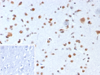 IHC staining of FFPE human brain tissue with NPM1 antibody (clone rNPM1/8056). Inset: PBS used in place of primary Ab (secondary Ab negative control). HIER: boil tissue sections in pH 9 10mM Tris with 1mM EDTA for 20 min and allow to cool before testing.