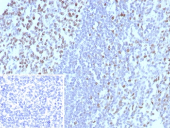 IHC staining of FFPE human tonsil tissue with MCM3 antibody (clone MCM3/8972R). Inset: PBS used in place of primary Ab (secondary Ab negative control). HIER: boil tissue sections in pH 9 10mM Tris with 1mM EDTA for 20 min and allow to cool before testing.