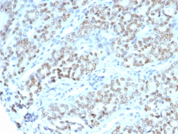 IHC staining of FFPE human fallopian tube tissue with BTBD9 antibody (clone BTBD9/7501). HIER: boil tissue sections in pH 9 10mM Tris with 1mM EDTA for 20 min and allow to cool before testing.