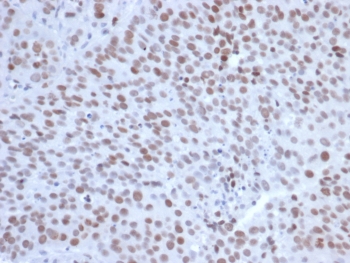 IHC staining of FFPE human tonsil tissue with EZH2 antibody (clone EZH2/6991). HIER: boil tissue sections in pH 9 10mM Tris with 1mM EDTA for 20 min and allow to cool before testing.