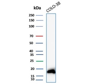 IHC staining of FFPE human skin tissue with MART-1 antibody (clone rMLANA/8180). HIER: boil tissue sections in pH 9 10mM Tris with 1mM EDTA for 20 min and allow to cool before testing.