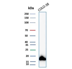 Western blot testing of human COLO-38 cell lysate with recombinant MART-1 antibody (clone MLANA/8108R). Expected molecular weight ~20 kDa with possible doublet.