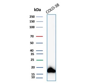 IHC staining of FFPE human skin tissue with MART-1 antibody (clone MLANA/8108R). HIER: boil tissue sections in pH 9 10mM Tris with 1mM EDTA for 20 min and allow to cool before testing.