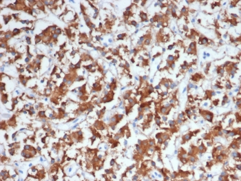 IHC staining of FFPE human adrenal gland tissue with Dopamine Beta-Hydroxylase antibody (clone DBH/7224). HIER: boil tissue sections in pH 9 10mM Tris with 1mM EDTA for 20 min and allow to cool before testing.