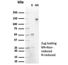 SDS-PAGE analysis of purified, BSA-free recombinant IL-7 antibody (clone IL7/7053R) as confirmation of integrity and purity.