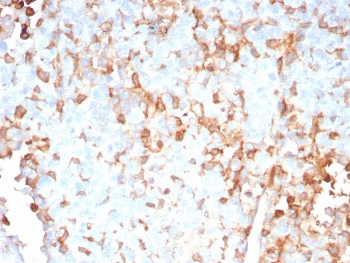 IHC staining of FFPE human adrenal gland tissue with IL-2 antibody (clone IL2/9007). HIER: boil tissue sections in pH 9 10mM Tris with 1mM EDTA for 20 min and allow to cool before testing.