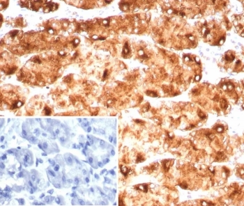 IHC staining of FFPE human stomach tissue with Blood Group Lewis y antibody (clone LWY/9243R). Inset: PBS used in place of primary Ab (secondary Ab negative control).