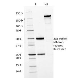 SDS-PAGE analysis of purified, BSA-free IgM antibody (clone IGHM/1623) as confirmation of integrity and purity.