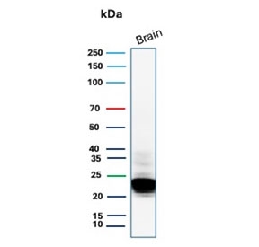 Western blot testing of human brain tissue with recombinant MBP antibody. Expected molecular weight: 22-37 kDa.