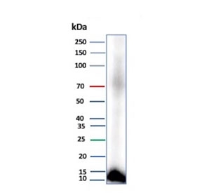 Western blot testing of human pancreas tissue lysate with CLPS antibody (clone CLPS/9021). Predicted molecular weight ~12 kDa.