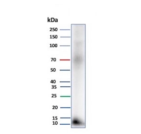 Western blot testing of human pancreas tissue lysate with Colipase antibody (clone CLPS/9027). Predicted molecular weight ~12 kDa.