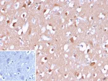 IHC staining of FFPE human brain tissue with Amyloid beta antibody (clone APP/3667). Inset: PBS used in place of primary Ab (secondary Ab negative control). HIER: boil tissue sections in pH 9 10mM Tris with 1mM EDTA for 20 min and allow to cool before testing.