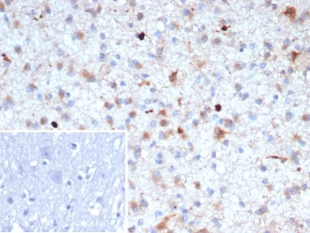IHC staining of FFPE human brain tissue with Beta Amyloid antibody (clone APP/4469). Inset: PBS used in place of primary Ab (secondary Ab negative control). HIER: boil tissue sections in pH 9 10mM Tris with 1mM EDTA for 20 min and allow to cool before testing.