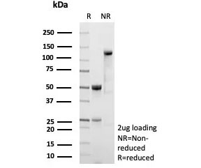 SDS-PAGE analysis of purified, BSA-free recombinant CD54 antibody (clone ICAM1/9379R) as confirmation of integrity and purity.