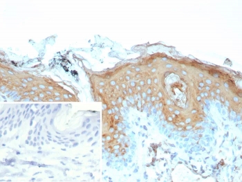 IHC staining of FFPE human skin tissue with recombinant IVL antibody (clone rIVRN/9323). Inset: PBS used in place of primary Ab (secondary Ab negative control). HIER: boil tissue sections in pH 9 10mM Tris with 1mM EDTA for 20 min and allow to cool before testing.