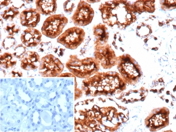IHC staining of FFPE human colon tissue with recombinant CD10 antibody (clone MME/9617R). Inset: PBS used in place of primary Ab (secondary Ab negative control).