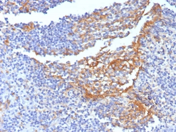 IHC staining of FFPE human tonsil tissue with CD14 antibody (clone LPSR/7738). HIER: boil tissue sections in pH 9 10mM Tris with 1mM EDTA for 20 min and allow to cool before testing.