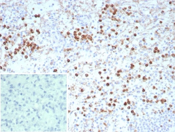 IHC staining of FFPE human spleen tissue with recombinant LAMP-3 antibody (clone rLAMP3/9131). Inset: PBS used in place of primary Ab (secondary Ab negative control). HIER: boil tissue sections in pH 9 10mM Tris with 1mM EDTA for 20 min and allow to cool before testing.