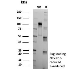 SDS-PAGE analysis of purified, BSA-free recombinant Apolipoprotein J antibody (clone CLU/9192R) as confirmation of integrity and purity.