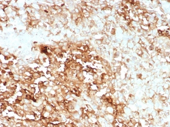 IHC staining of FFPE human adrenal gland tissue with recombinant CLU antibody (clone rCLU/9149). HIER: boil tissue sections in pH 9 10mM Tris with 1mM EDTA for 20 min and allow to cool before testing.