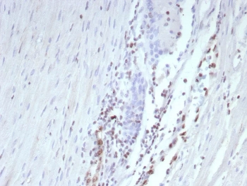 IHC staining of FFPE human prostate tissue with recombinant Transcriptional Regulator ERG antibody (clone ERG/9122R) at 2ug/ml. HIER: boil tissue sections in pH 9 10mM Tris with 1mM EDTA for 20 min and allow to cool before testing.