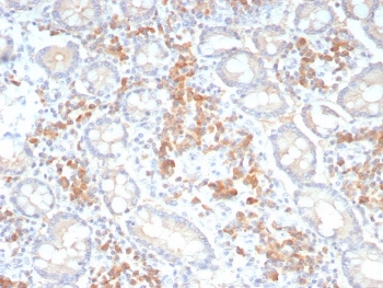 IHC staining of FFPE human colon tissue with Pan-Cadherin antibody (clone Pan-CAD/8019). HIER: boil tissue sections in pH 9 10mM Tris with 1mM EDTA for 20 min and allow to cool before testing.