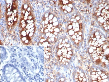 IHC staining of FFPE human colon tissue with Carcinoembryonic antigen-related cell adhesion molecule 1 antibody (clone CEACAM1/4837). Inset: PBS used in place of primary Ab (secondary Ab negative control). HIER: boil tissue sections in pH 9 10mM Tris with 1mM EDTA for 20 min and allow to cool before testing.