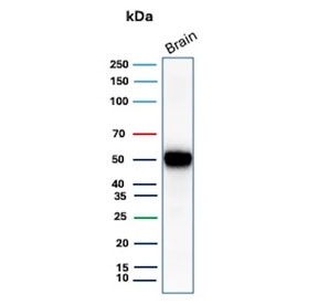 Western blot testing of human brain tissue lysate with GFAP antibody (clone GFAP/9421). Predicted molecular weight ~50 kDa.